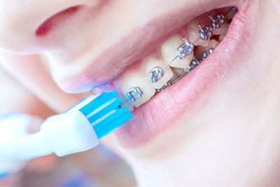 Basic Oral Hygiene For Young Children And Orthodontics
