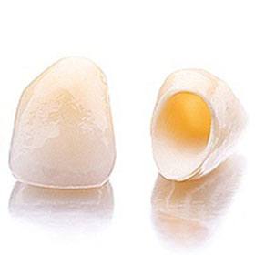 Dental Crowns and Dental Bridges