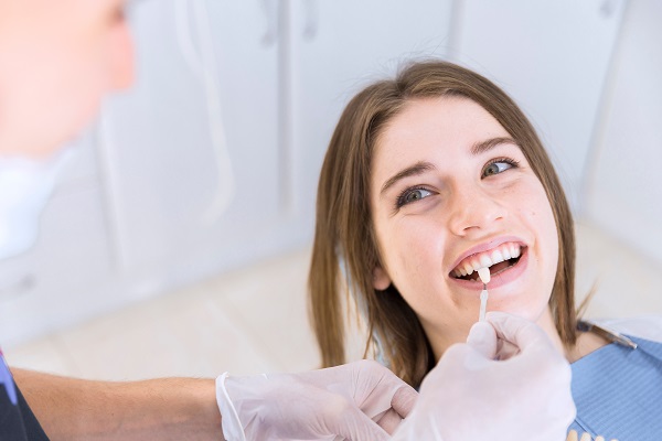 Dental Veneers Can Change A Smile