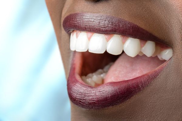 When To Consider A Full Mouth Reconstruction