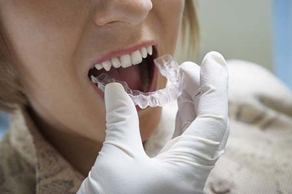 Invisalign Treatment