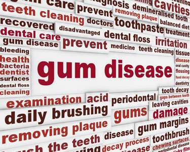 periodontal Disease