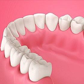 Periodontics Albuquerque, NM