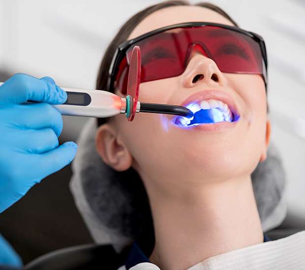 Albuquerque Professional Teeth Whitening