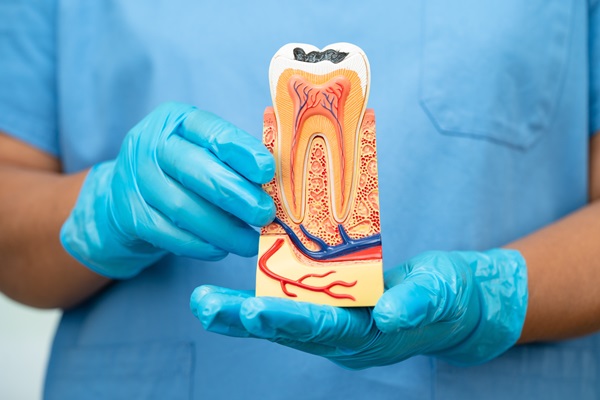 Three Signs You May Need A Root Canal
