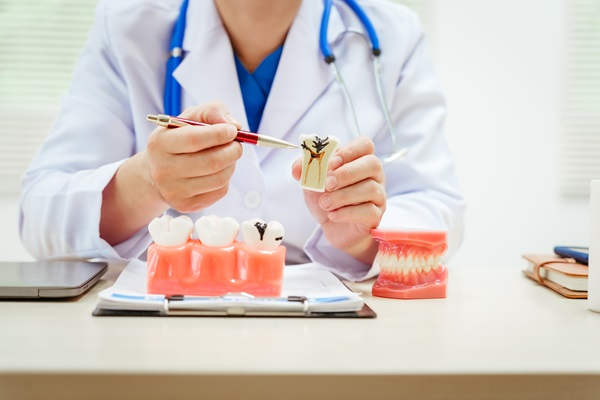 When Root Canal Therapy May Be Recommended